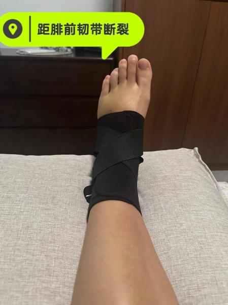 24岁德凯特拉雷右膝重伤,半月板撕裂康复漫长